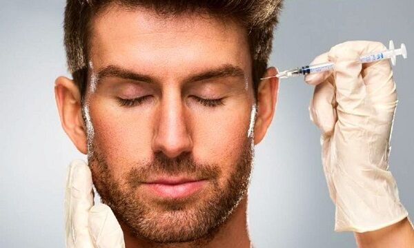 Rewind Aesthetics | 5 x Upper facial injections for one